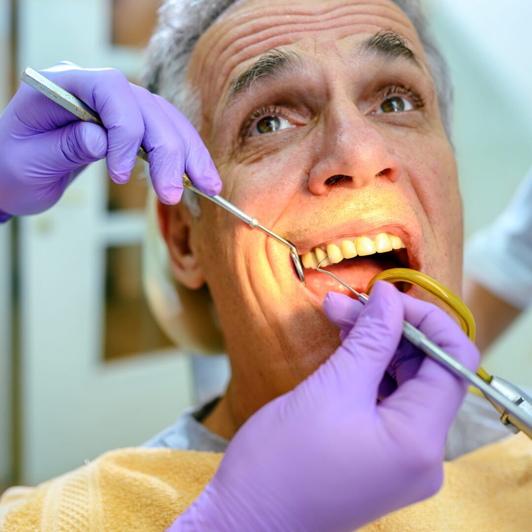Man undergoing dental check-up