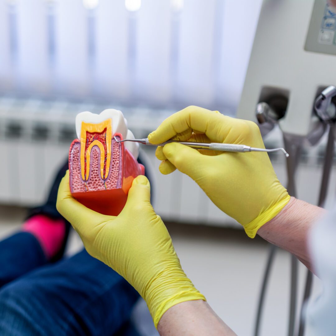 Yellow-gloved hands holding dental model