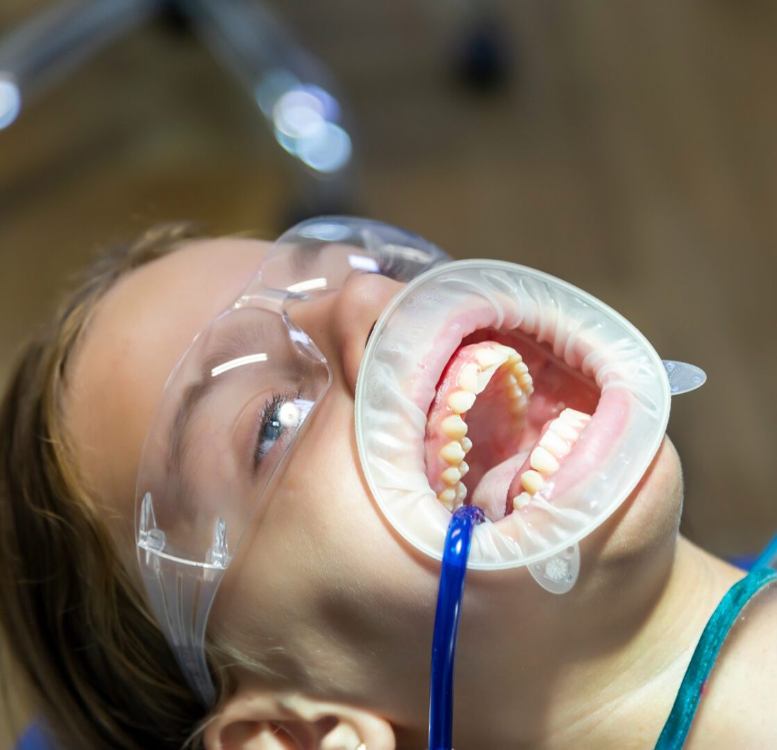 Child at dentist's office with mouth opener