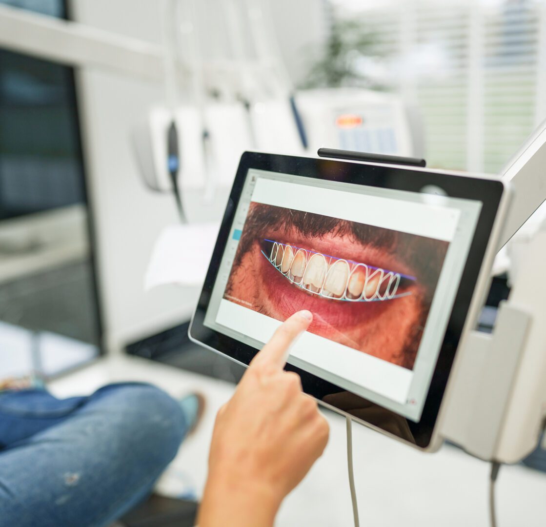 Dental scan on tablet screen