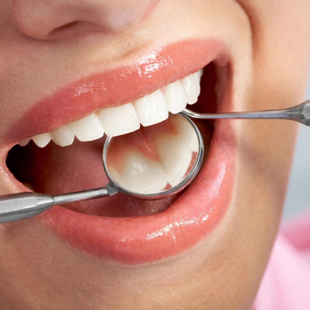 Dentist inspecting teeth with instruments